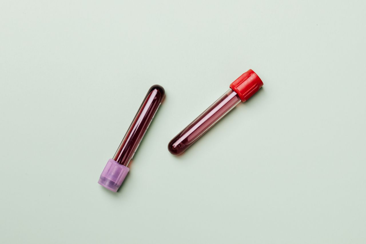 Blood sample test tubes in a laboratory tray